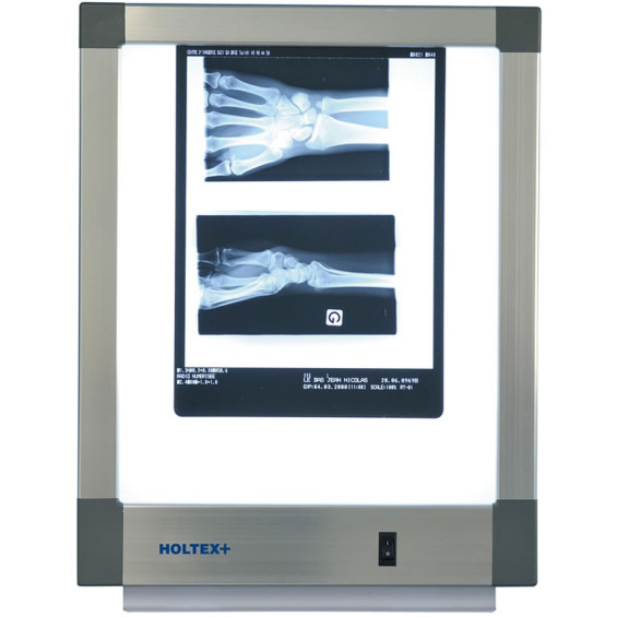 Négatoscope